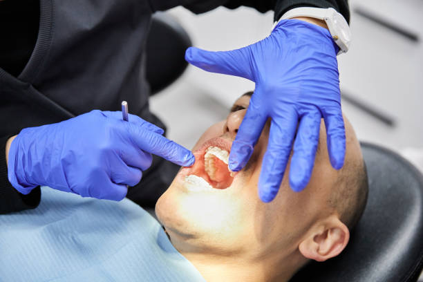 Best Emergency Tooth Extraction in Fairplains, NC