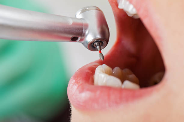 Best Emergency Root Canal Treatment in Fairplains, NC